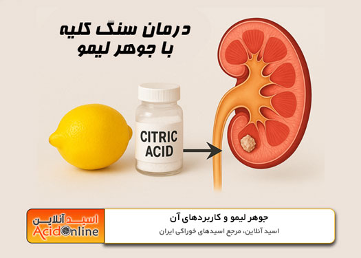سنگ کلیه و لیمو اسید سیتریک