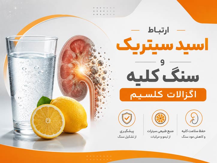 سنگ کلیه اگزالات کلسیم و درمان آن با اسید سیتریک